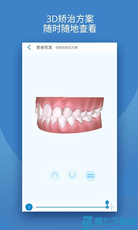 iortho时代天使手机app v11.0.1 安卓最新版 0