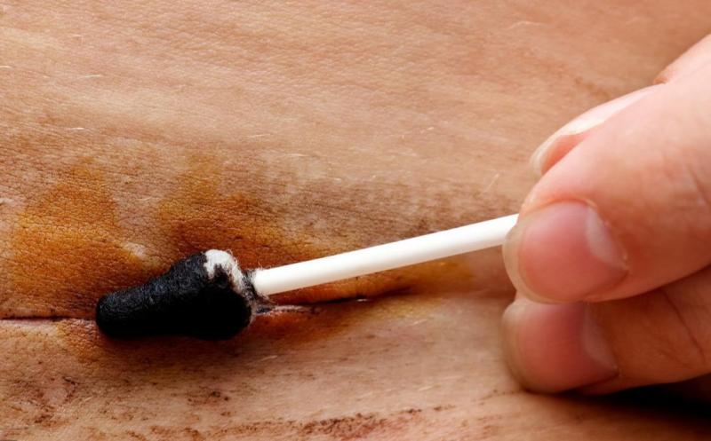 被猫抓伤的死亡率为零（被猫咪抓伤后一定会患上狂犬病吗）