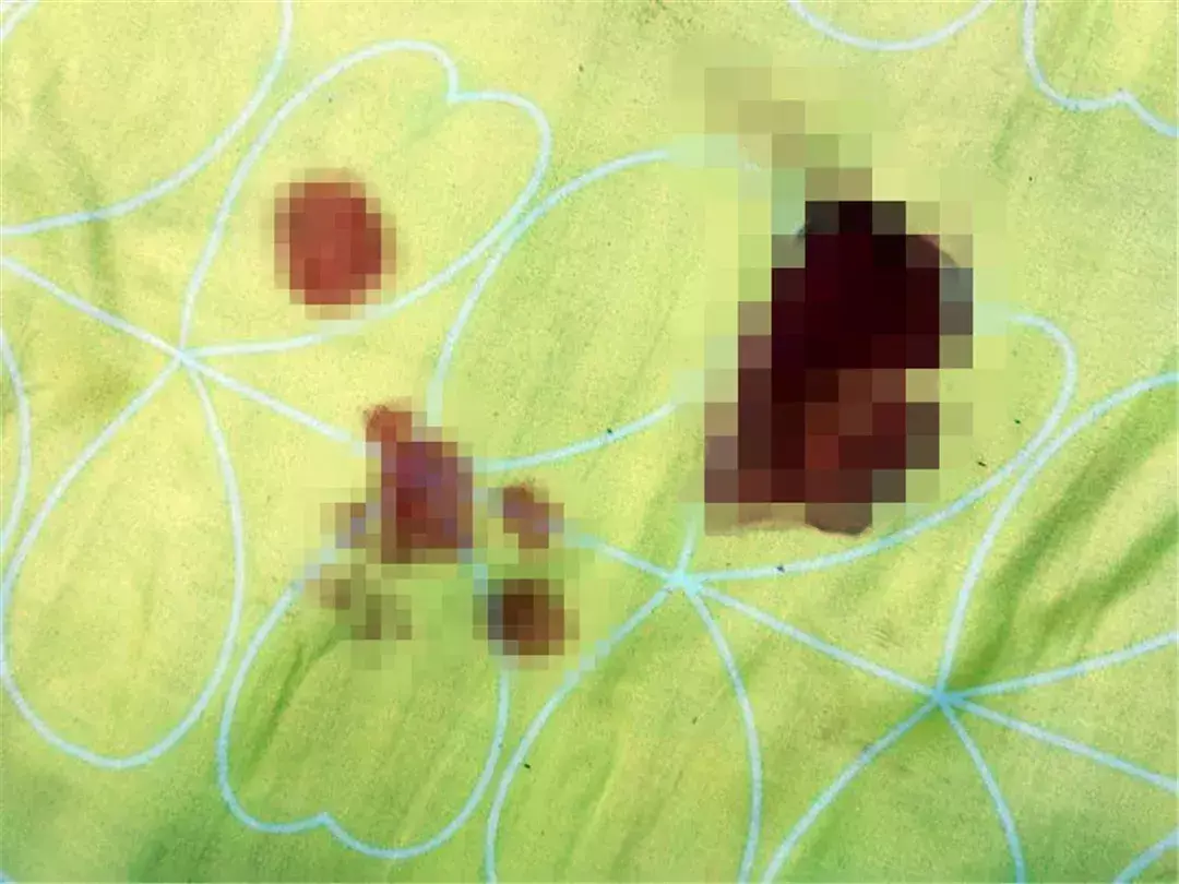 母猫绝育第一天夜里是危险期(绝育后母猫恢复伤口愈合快的护理方法)